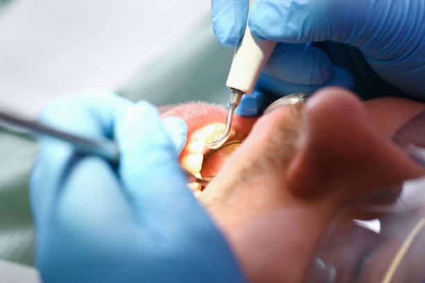 Best Emergency Treatment for Toothache in Lawrenceville, NJ