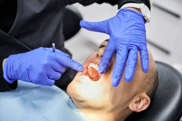 Best Emergency Tooth Extraction in Lawrenceville, NJ